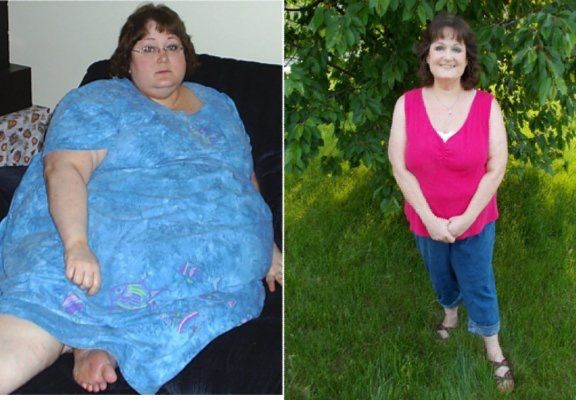 How Beth Lost 230+ Pounds and Reclaimed Her Life | SparkPeople