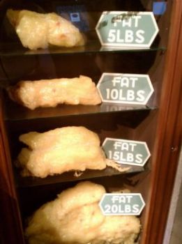 10 Lbs Of Fat Look Like